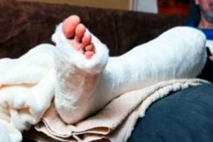 Crushed leg injury and PTSD compensation