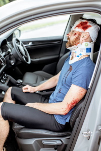 Injured passenger with a bloodied, but bandaged, forehead. He is sitting in in the passenger's side of a car. 
