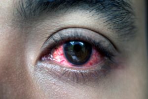 Accident at work eye injury compensation
