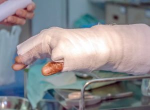 Accident at work hand injury compensation