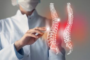 personal injury claim for a spinal cord injury