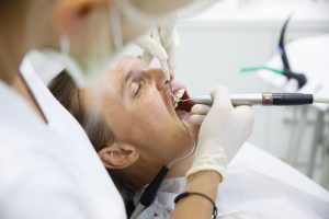 Dental Negligence Claims FAQs