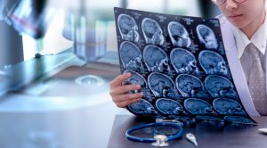 A doctor looking at a patient's brain scans after a head injury caused by an accident.