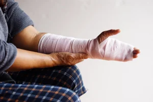 A close up image of a sprained wrist which has been bandaged. 