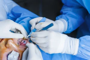 A cosmetic surgeon uses a surgical instrument to work around the eye of a female patient.